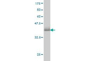 Western Blot detection against Immunogen (36. (CAMK1 antibody  (AA 271-370))
