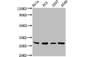 Western Blot Positive WB detected in: Hela whole cell lysate, PC-3 whole cell lysate, 293T whole cell lysate, A549 whole cell lysate All lanes: EFHD1 antibody at 3.