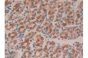 DAB staining on IHC-P; Samples: Human Stomach Tissue (Intrinsic Factor antibody  (AA 198-413))