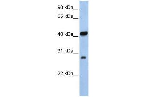Human 721_B; WB Suggested Anti-ZFAND3 Antibody Titration: 0. (ZFAND3 antibody  (N-Term))