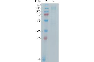 Insulin-Like Growth Factor 1 Receptor (IGF1R) (AA 31-936) protein (His tag)