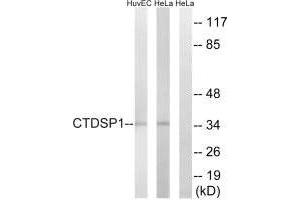 Western blot analysis of extracts from HUVEC cells and HeLa cells, using CTDSP1 antibody. (CTDSP1 antibody  (N-Term))
