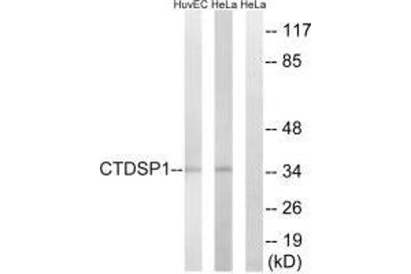 CTDSP1 抗体  (N-Term)