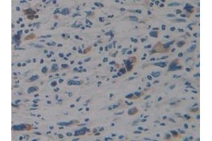 Immunohistochemistry (IHC) image for anti-Signal Transducer and Activator of Transcription 2, 113kDa (STAT2) (AA 616-849) antibody (ABIN7434083)