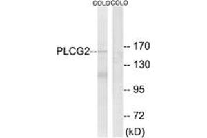 Western blot analysis of extracts from COLO205 cells, using PLCG2 (Ab-753) Antibody.