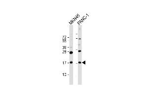 All lanes : Anti-FB Antibody (C-Term) at 1:2000 dilution Lane 1: MKN45 whole cell lysate Lane 2: NC-1 whole cell lysate Lysates/proteins at 20 μg per lane. (FAM159B antibody  (AA 121-154))