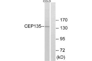Western blot analysis of extracts from COLO cells, using CEP135 antibody. (CEP135 antibody  (C-Term))