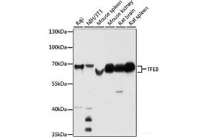 Western blot analysis of extracts of various cell lines using TFEB Polyclonal Antibody at dilution of 1:1000. (TFEB antibody)