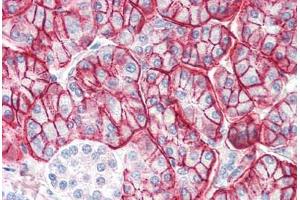 Human Pancreas (formalin-fixed, paraffin-embedded) stained with ENPP1 antibody ABIN337063 at 2. (ENPP1 antibody  (AA 915-925))