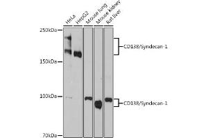 Western blot analysis of extracts of various cell lines, using Syndecan 1 Rabbit mAb (ABIN1683195, ABIN3018651, ABIN3018652 and ABIN7101639) at 1:1000 dilution. (Syndecan 1 antibody)