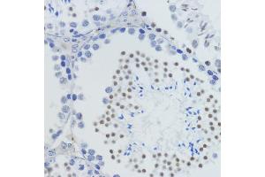 Immunohistochemistry of paraffin-embedded mouse testis using MonoMethyl-Histone H4-K20 antibody (ABIN3016044, ABIN3016045, ABIN3016046, ABIN1680258 and ABIN6219531) at dilution of 1:200 (40x lens). (Histone H4 antibody  (meLys20))