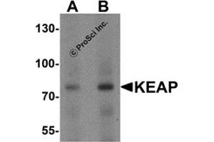 Western Blotting (WB) image for anti-Kelch-Like ECH-Associated Protein 1 (KEAP1) (C-Term) antibody (ABIN1077378) (KEAP1 antibody  (C-Term))