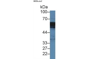 Detection of ANXA11 in Mouse Placenta lysate using Polyclonal Antibody to Annexin A11 (ANXA11) (Annexin A11 antibody  (AA 1-505))