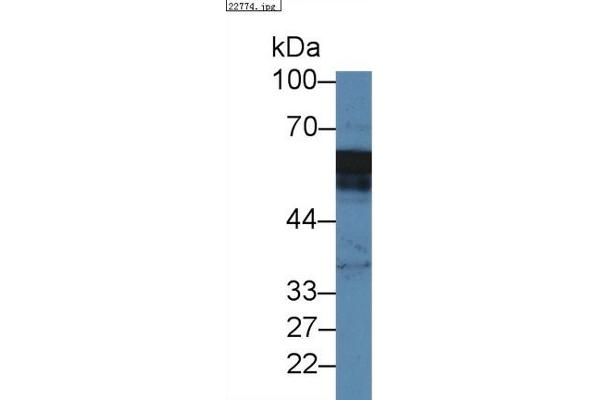 Annexin A11 antibody  (AA 1-505)