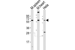 All lanes : Anti-Rad9a Antibody (C-term) at 1:2000 dilution Lane 1: mouse spleen lysates Lane 2: mouse heart lysates Lane 3: Hela whole cell lysates Lysates/proteins at 20 μg per lane. (RAD9A antibody  (C-Term))