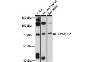 Western blot analysis of extracts of various cell lines, using GP antibody (ABIN7267287) at 1:1000 dilution. (GPATCH2 antibody  (AA 1-250))