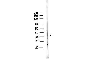 Western blot analysis of lysates from COLO205 cells, using MPRG Antibody at 1/1000 dilution.