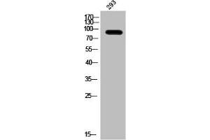 Western Blot analysis of 293 cells using Phospho-IL-4Rα (Y497) Polyclonal Antibody (IL4 Receptor antibody  (pTyr497))