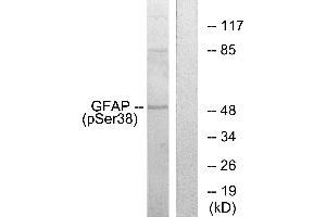Western blot analysis of extracts from HeLa cells, using GFAP (Phospho-Ser38) antibody. (GFAP antibody  (pSer38))