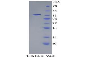 SDS-PAGE analysis of Human HSD17B1 Protein. (HSD17B1 Protein)