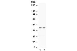Western blot testing of human 1) HeLa and 2) K562 cell lysate with CD58 antibody. (CD58 antibody)