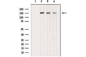 anti-Insulin Receptor alpha (ISR-alpha) (Internal Region) antibody