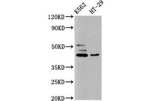 Western Blot Positive WB detected in: K562 whole cell lysate, HT29 whole cell lysate All lanes: B3GNT6 antibody at 10 μg/mL Secondary Goat polyclonal to rabbit IgG at 1/50000 dilution Predicted band size: 43, 30 kDa Observed band size: 43 kDa