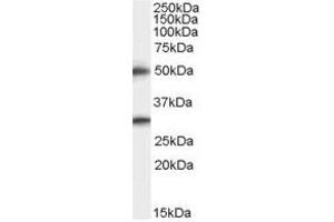 Image no. 1 for anti-Transmembrane Protease, serine 5 (TMPRSS5) (C-Term) antibody (ABIN374177) (TMPRSS5 antibody  (C-Term))