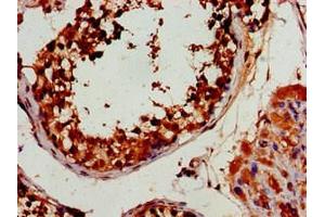 Immunohistochemistry of paraffin-embedded human testis tissue using ABIN7165627 at dilution of 1:100 (HEXIM2 antibody  (AA 1-286))