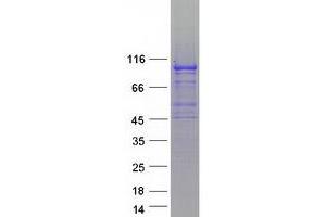 Validation with Western Blot