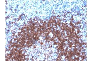 Formalin-fixed, paraffin-embedded human Tonsil stained with CD79a Rabbit Recombinant Monoclonal Antibody (IGA/1790R).