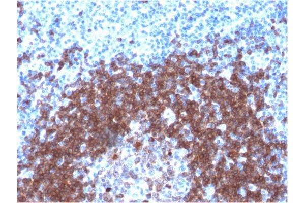 Recombinant CD79a antibody  (AA 202-216)