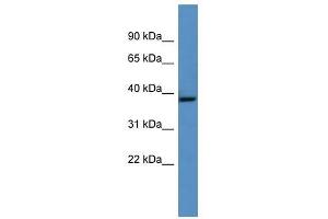 Ghitm antibody used at 0. (GHITM antibody  (Middle Region))