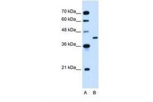 Image no. 1 for anti-Glutamic-Oxaloacetic Transaminase 2, Mitochondrial (Aspartate Aminotransferase 2) (GOT2) (AA 40-89) antibody (ABIN320795) (GOT2 antibody  (AA 40-89))