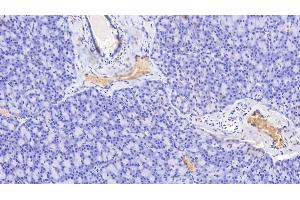 Detection of HB in Human Pancreas Tissue using Polyclonal Antibody to Hemoglobin (HB) (Hemoglobin antibody)