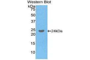 Western Blotting (WB) image for anti-Fc Fragment of IgG, Low Affinity IIIb, Receptor (CD16b) (FCGR3B) (AA 24-203) antibody (ABIN1858834) (FCGR3B antibody  (AA 24-203))