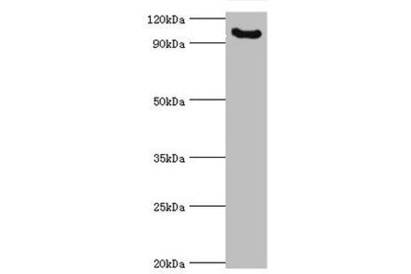 MCPH1 antibody  (AA 536-835)