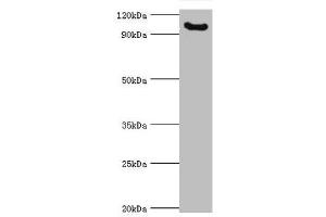 Western blot All lanes: Microcephalin antibody at 3 μg/mL + Mouse liver tissue Secondary Goat polyclonal to rabbit IgG at 1/10000 dilution Predicted band size: 93, 63, 68 kDa Observed band size: 93 kDa (MCPH1 antibody  (AA 536-835))