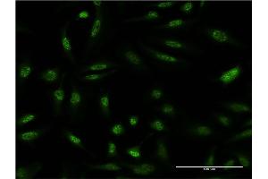 Immunofluorescence of monoclonal antibody to DUSP1 on HeLa cell. (DUSP1 antibody  (AA 305-367))