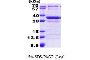 SDS-PAGE (SDS) image for CCR4-NOT Transcription Complex, Subunit 8 (CNOT8) (AA 1-292) protein (His tag) (ABIN5853036)