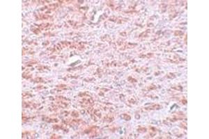 Immunohistochemistry (IHC) image for anti-Caudal Type Homeobox 2 (CDX2) (C-Term) antibody (ABIN1030331) (CDX2 antibody  (C-Term))