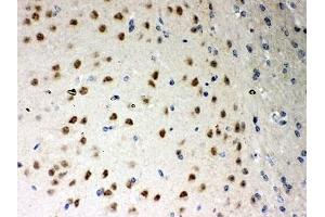 IHC-P: PKC iota antibody testing of mouse brain tissue (PKC iota antibody  (AA 21-214))