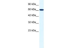 WB Suggested Anti-ZNF266 Antibody Titration:  0.