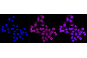 anti-Peptidylprolyl Isomerase A (Cyclophilin A) (PPIA) antibody