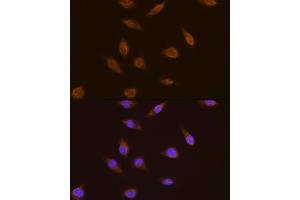 Immunofluorescence analysis of L929 cells using TSG101 antibody  at dilution of 1:100. (TSG101 antibody  (C-Term))
