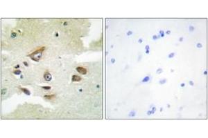 Immunohistochemistry analysis of paraffin-embedded human brain, using CLUS Antibody. (Clusterin antibody  (AA 400-449))