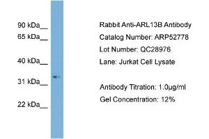 WB Suggested Anti-ARL13B  Antibody Titration: 0. (ARL13B antibody  (Middle Region))
