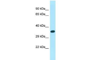 Western Blotting (WB) image for anti-XK, Kell Blood Group Complex Subunit-Related Family, Member 6 (XKR6) (C-Term) antibody (ABIN2790601) (XKR6 antibody  (C-Term))