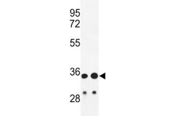 IgH anticorps  (AA 290-320)