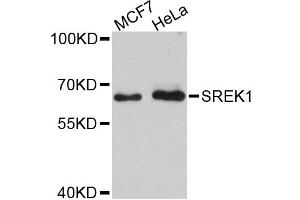 Western blot analysis of extracts of various cell lines, using SREK1 antibody. (SFRS12 antibody)